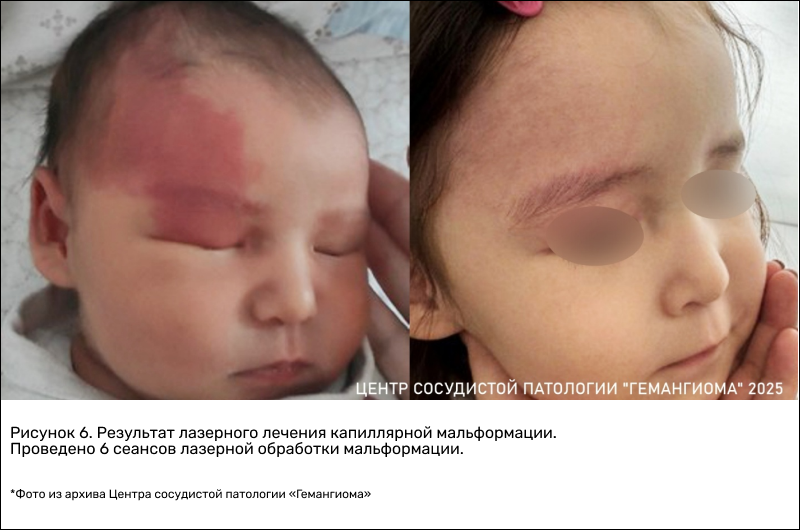 frame_773_(1).png (393 KB)