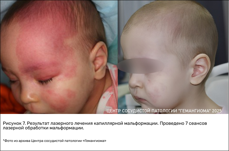 frame_774_(1).png (369 KB)